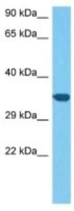 DTW Domain Containing 2 Rabbit anti-Mouse, Polyclonal, Novus Biologicals 100 &mu;g | Buy Online | Novus Biologicals | Fisher Scientific